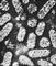 Различные типы вирионов под электронным микроскопом. Вирус мозаичной болезни люцерны.