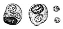 Рис. 1. Theileria annulata — «коховские шары».