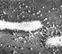 Электронная микрофотография кишечной палочки, окруженной частицами заражающего её фага Т2.
