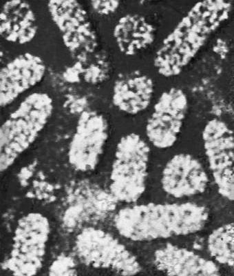 Вирус мозаичной болезни люцерны