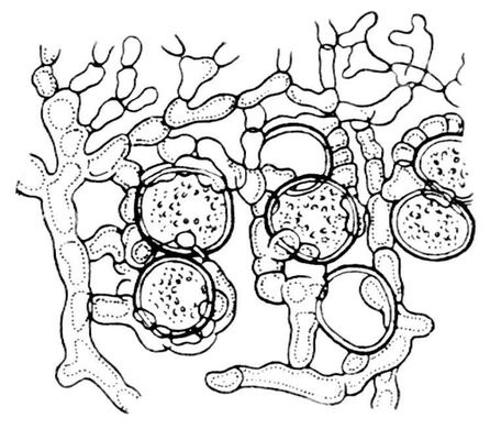 Клетки водоросли, охваченные гифами гриба