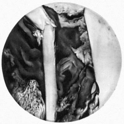 Рентгеновская микрофотография среза кости человека